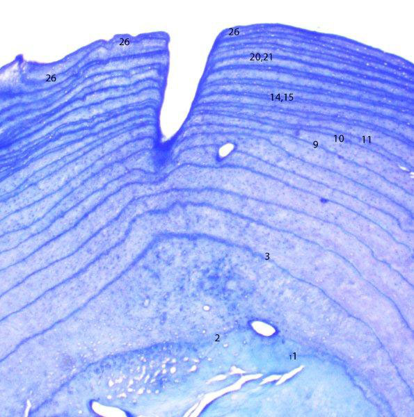 Midge's tooth section - 2009