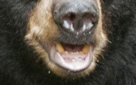 Yellowed teeth show age